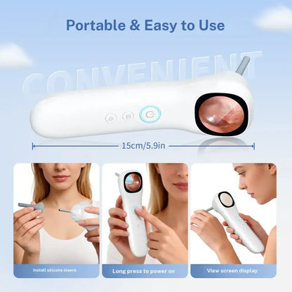 Smart Ear Camera