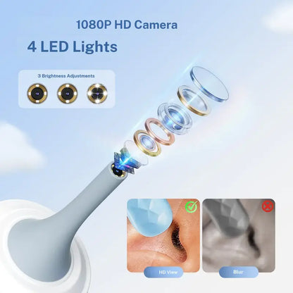Smart Ear Camera