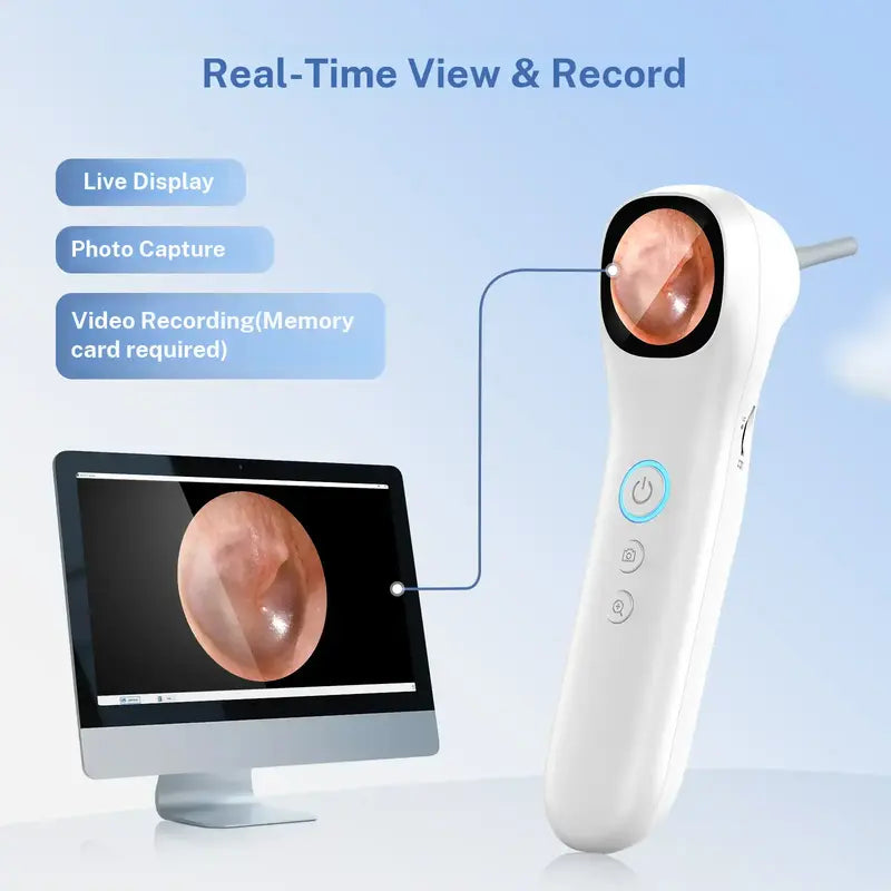 Smart Ear Camera