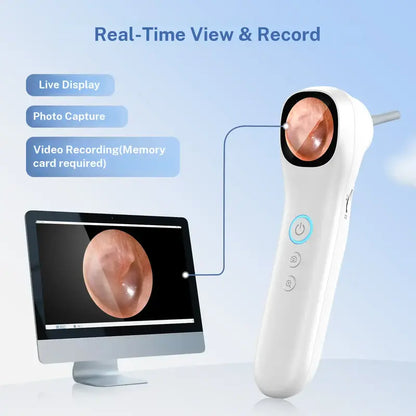 Smart Ear Camera